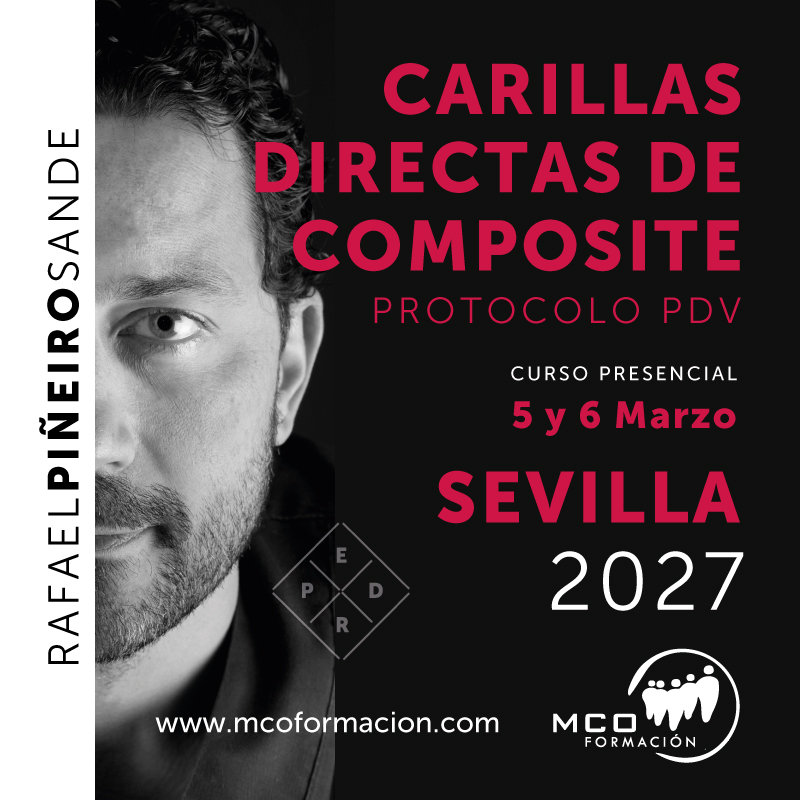 Curso Carillas Directas Composite Sevilla Curso Carillas Directas Composite Sevilla